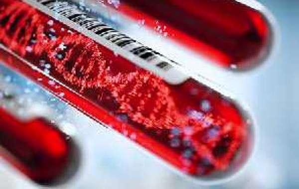 Liquid Biopsy Market Size Growing at 17.8% CAGR Set to Reach USD 10.9 Billion By 2028